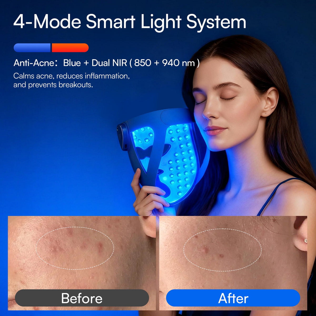 4D Wireless 940 nm Dual Near-Infrared LED Mask