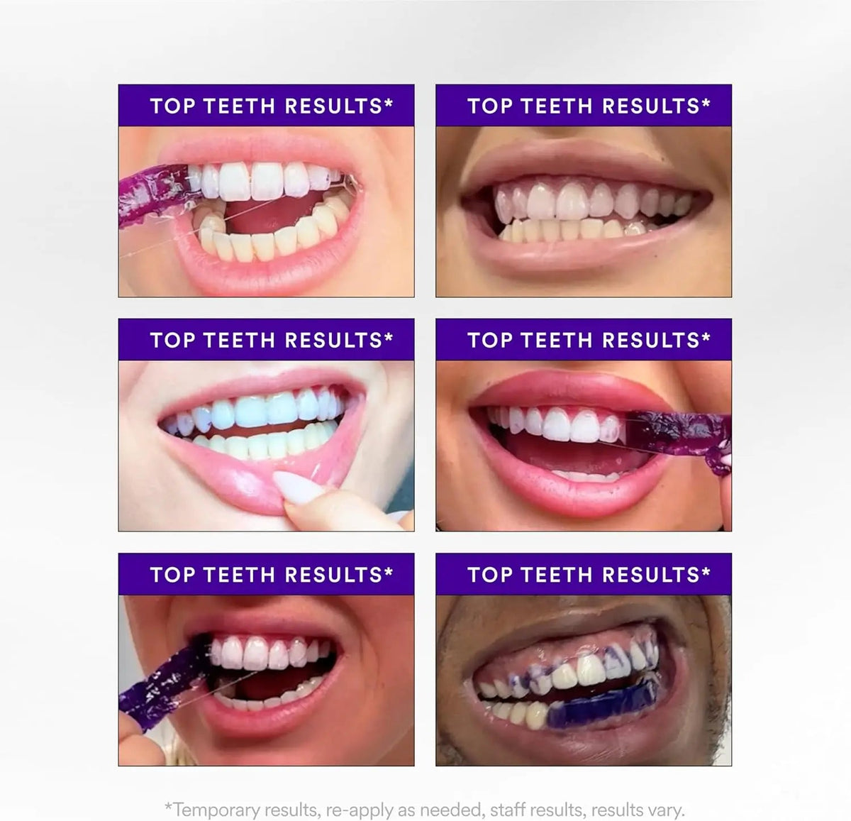 Hiismile V34 Whitening Strips